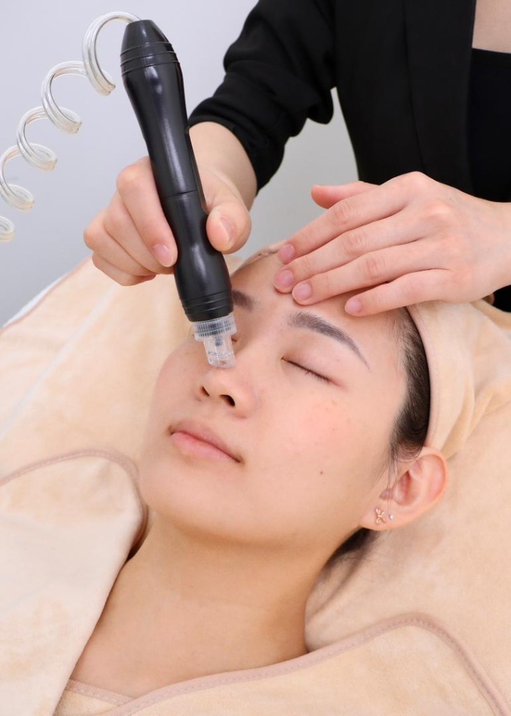 Aqua Silk Peel Treatment - Image 1